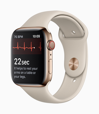 Apple Watchの心電図アプリで、若年性がん患者のQT時間延長に関する研究開始