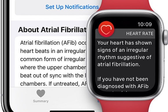 Apple Watchの「不規則な心拍の通知」が致命的な心臓腫瘍発見に繋がる