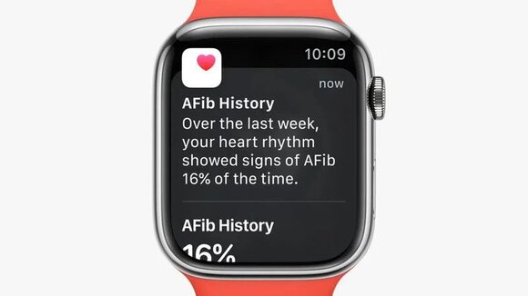 Apple Watchの心電図アプリによる心房細動発生の記録機能、カナダで承認
