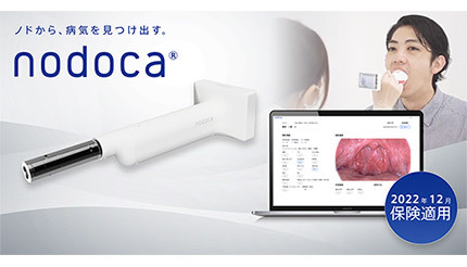 AI搭載の咽頭内視鏡システムによる感染症診断が保険適用、日本初の事例