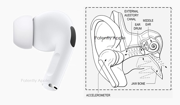 Apple、AirPodsで歯ぎしりの検出が行えるヘルスケア機能の特許を出願