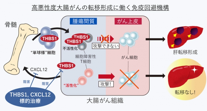 悪性度が高い大腸がんの転移、骨髄が促進に関係 抑制の治療法開発へ 京大