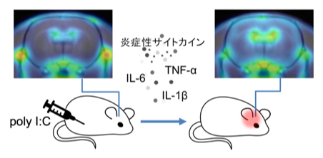 ウイルス感染後に続く倦怠感のメカニズム解明へ 理研の研究