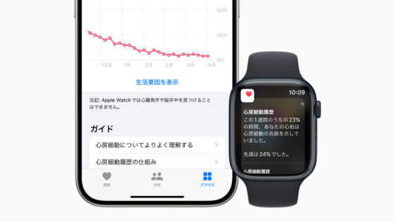 日本のApple Watchユーザーが「心房細動履歴」機能を利用可能に