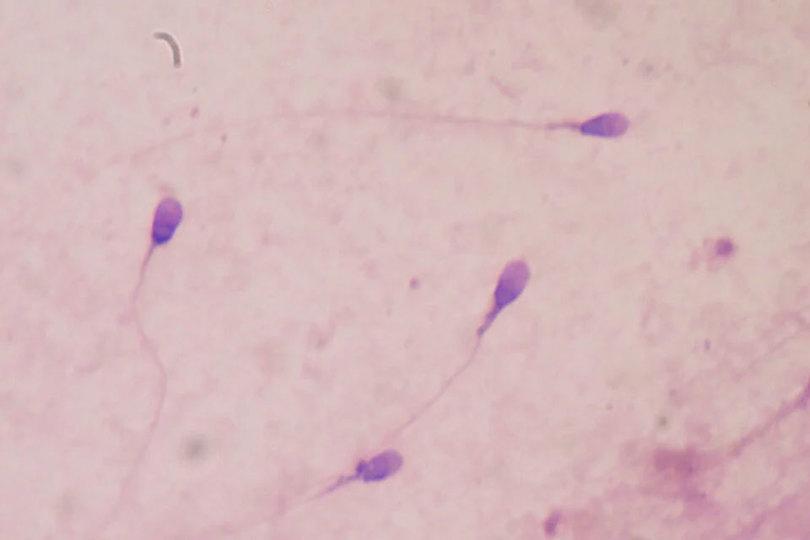 次世代不妊治療研究、バイオ系スタートアップが生殖機能を持つ精子細胞の育成に成功